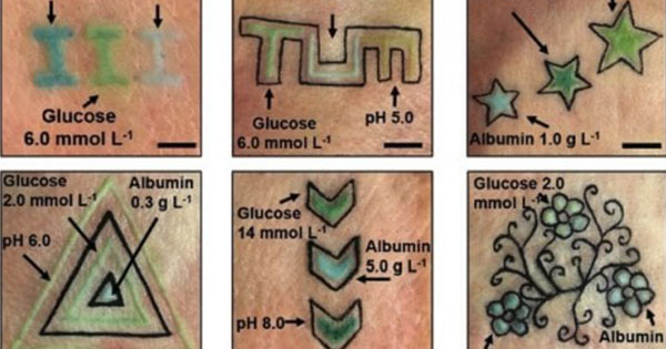 Tatuaggi per monitorare le malattie croniche: l’idea tedesca